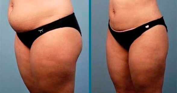 meetodid kehakaalu langetamiseks 10 kilogrammi kuus